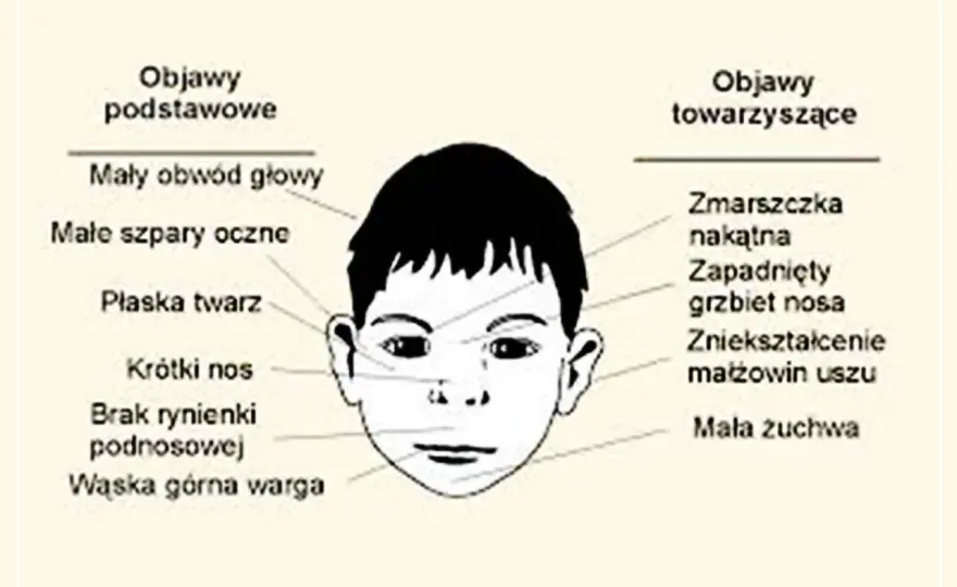 FAS - objawy, diagnoza i wsparcie. Jak pomóc dziecku?